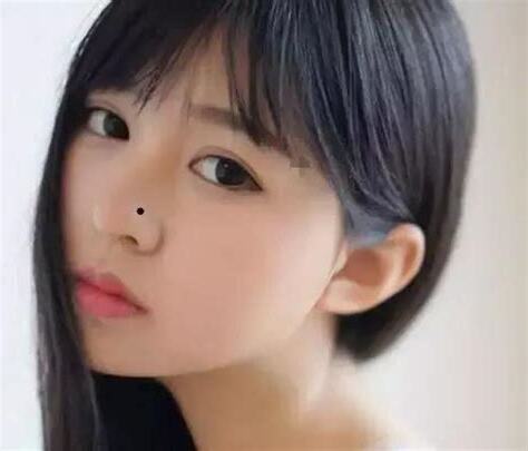 鼻樑 痣